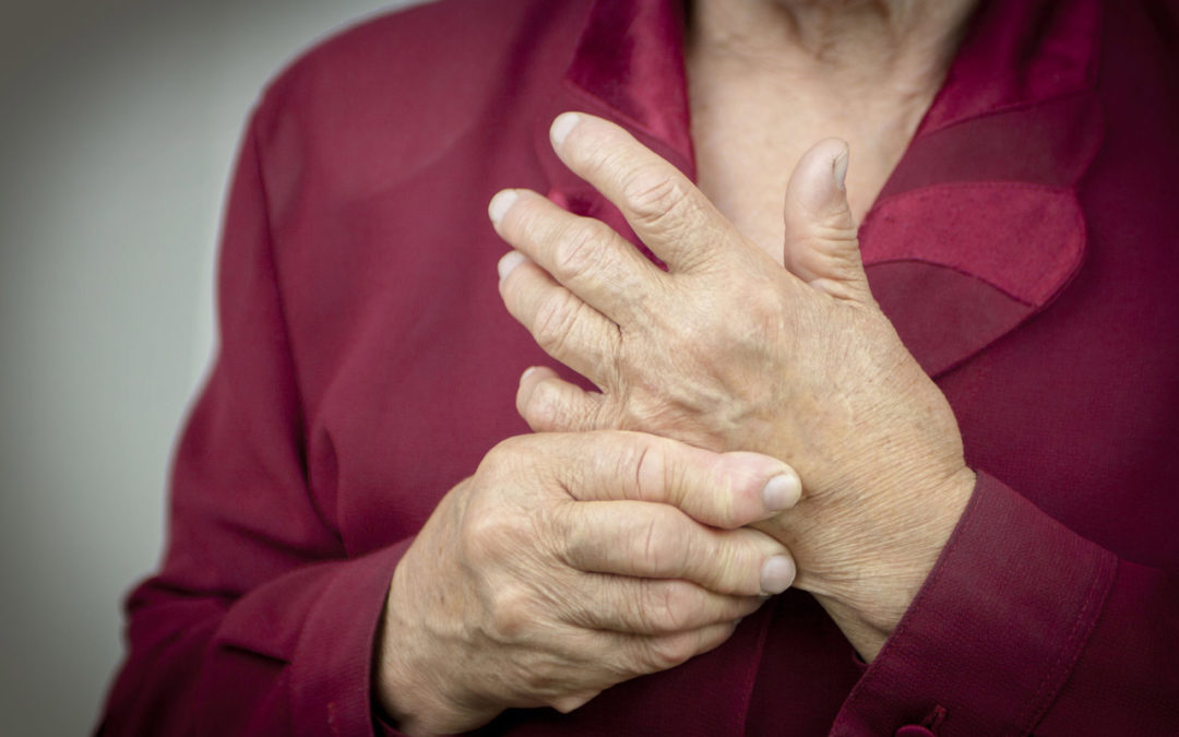Arthritis